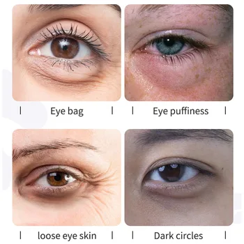 30 мл VC копър витамин С копър за очи за премахване на торбички под очите изчезват фините линии, подобрява тъмните кръгове черен пигмент на кожата
