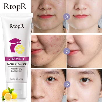 RtopR Витамин С Почистващо средство за лице Дълбоко Почиства кожата от акне, контролира свиване на порите, стягане на грижи за кожата, Почистване на лицето